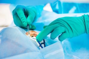 Χειρουργική Πτερυγίου με Αυτομόσχευμα Επιπεφυκότα